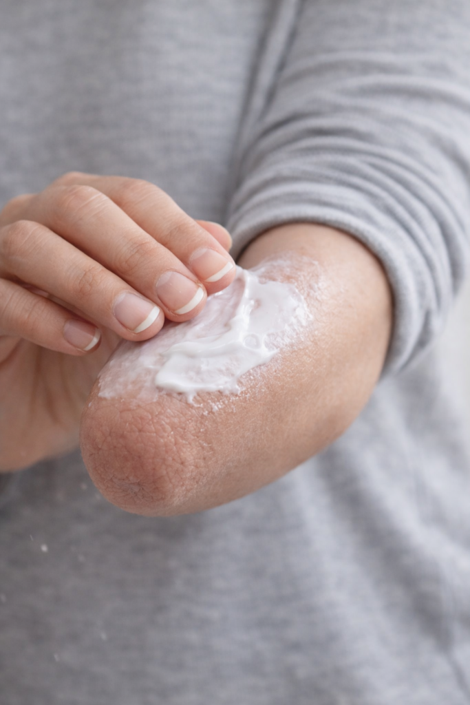 Photo of a light skinned hand applying lotion to a partial arm with the background of a person wearing a grey shirt  