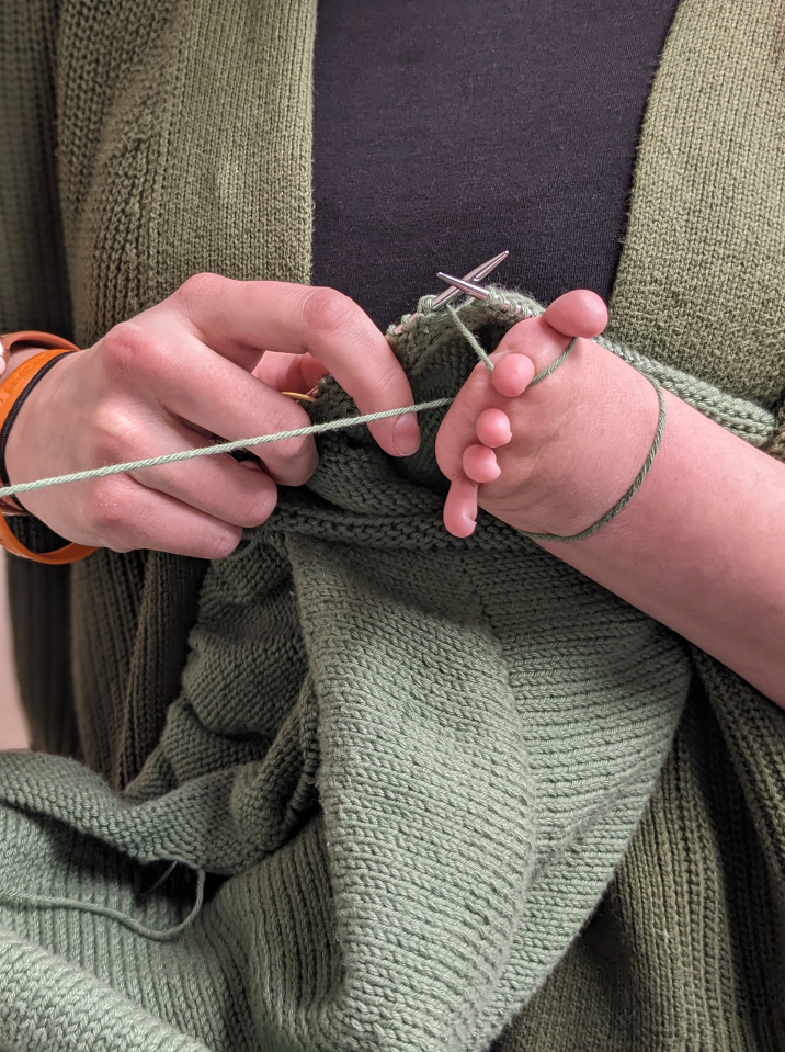 An adult with a congenital upper limb difference uses their finger nubbins to stabilize yarn while knitting.